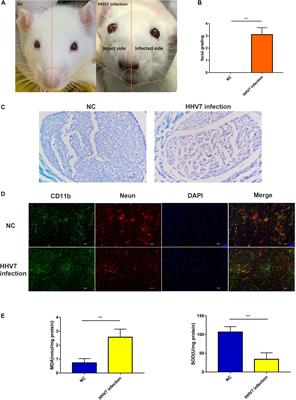 Cox4i2 Triggers an Increase in Reactive Oxygen Species, Leading to Ferroptosis and Apoptosis in HHV7 Infected Schwann Cells